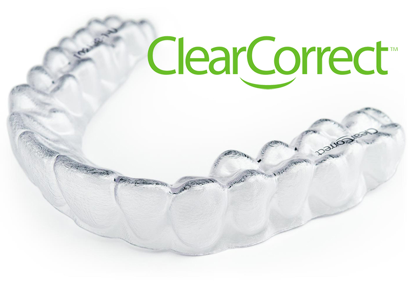 Teeth Straightening Using Clear Aligner Technology Dentist in Leeds